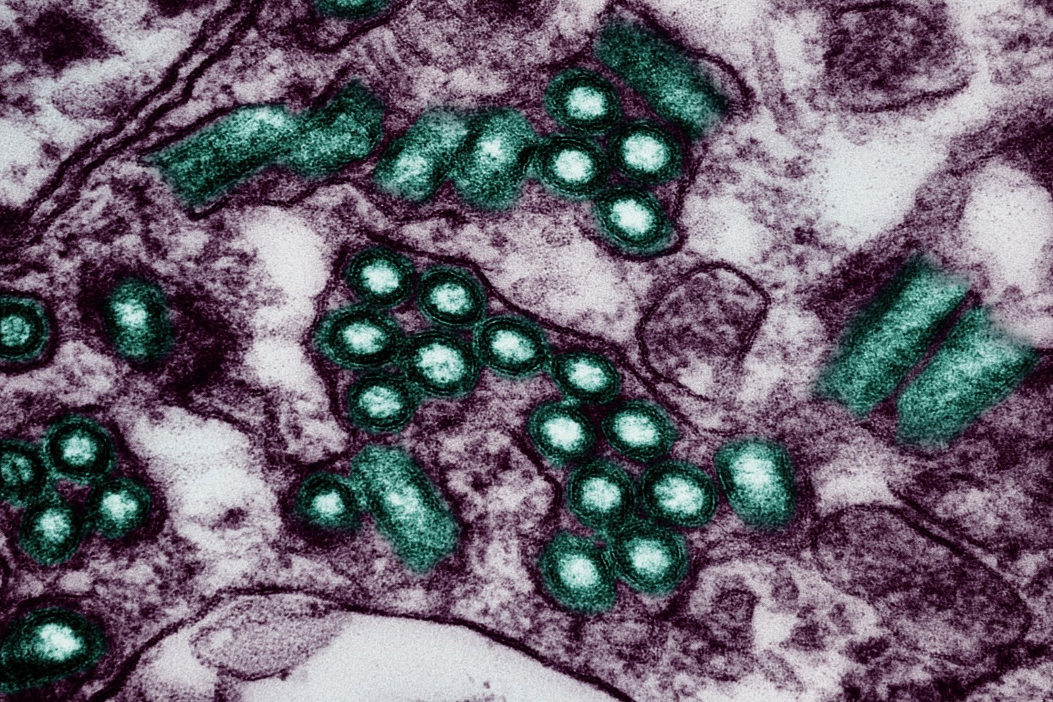 Rabies Virus